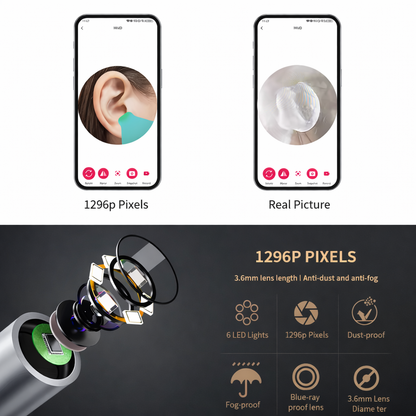 Visual Ear Cleaner with HD Camera & LED Light